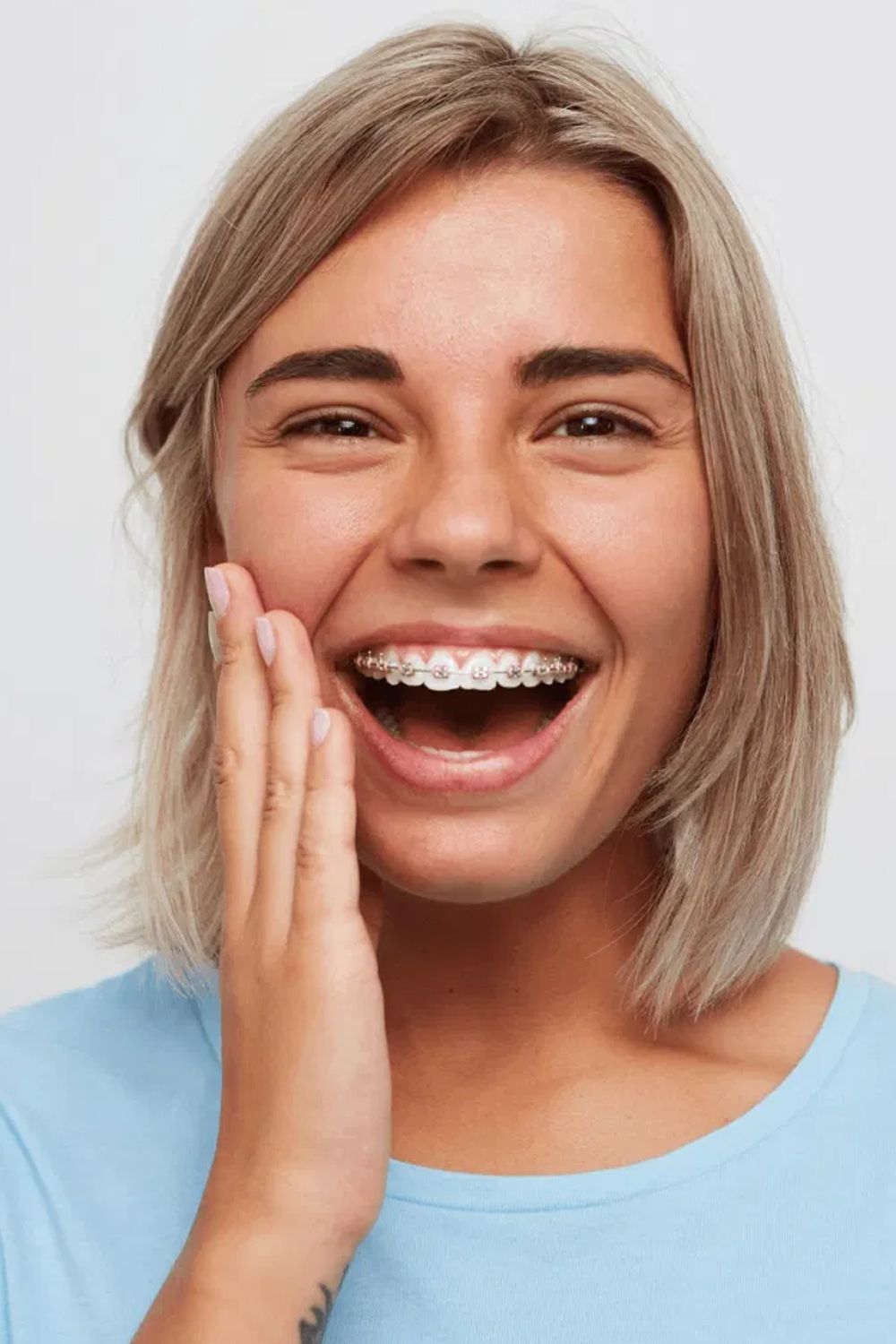 Metal braces at TruCare Clinics